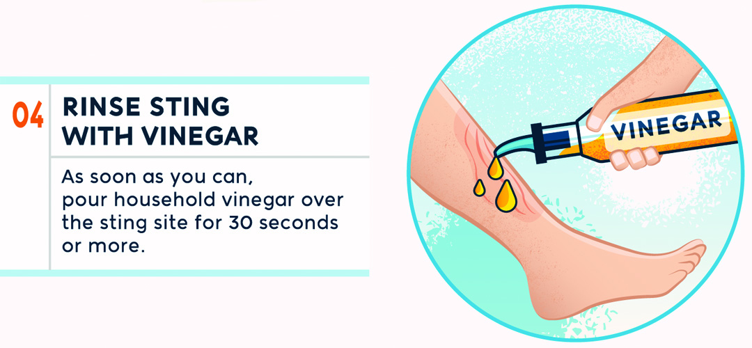 The Ultimate Guide to Jellyfish